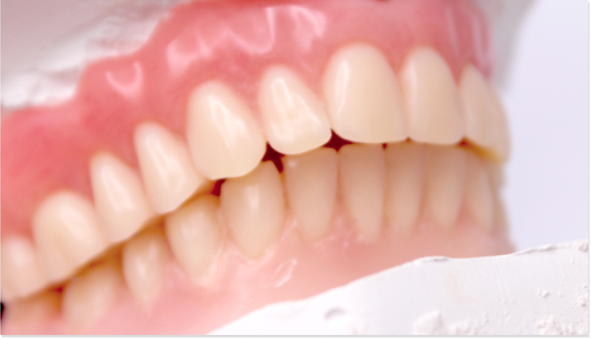 image d'une dentition saine et d'une bonne hygiène dentaire