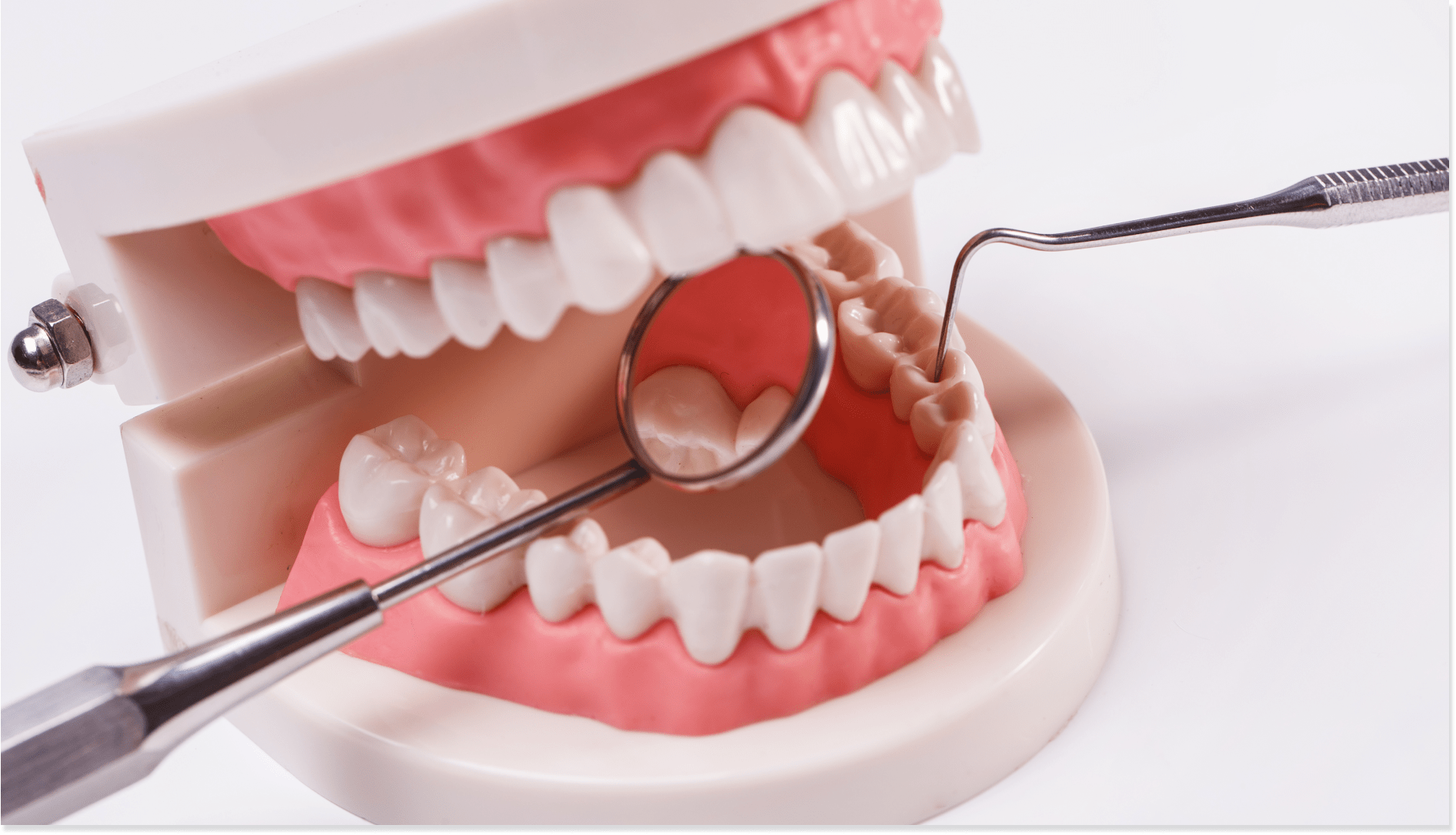 Odontologie conservatrice
