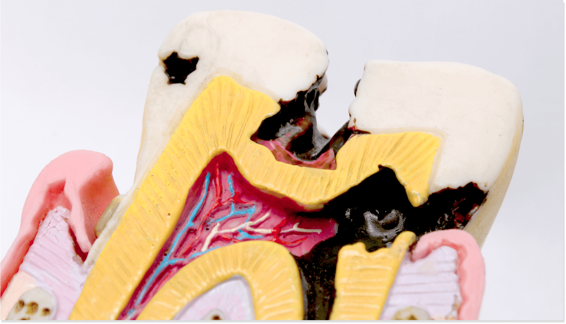 endodontie